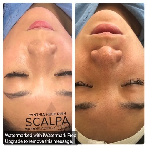 Customer photo review of Fibroblast Training Course