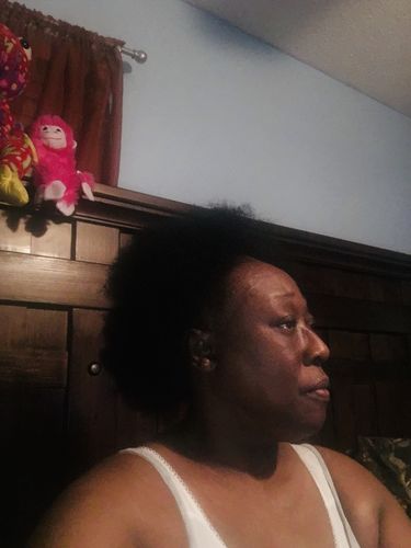 Customer photo review of PureFix Hair Elixir