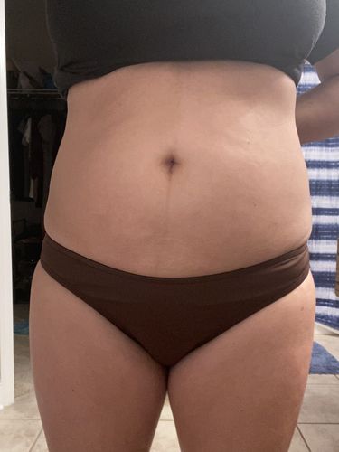 Customer photo review of 45 Uses Herbal Magnesium Therapy Wrap: Legs/Core