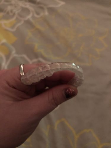 Customer photo review of Night Guard