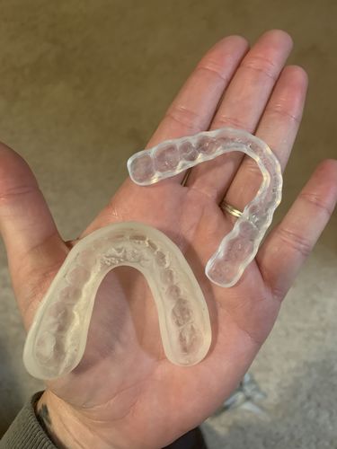 Customer photo review of Night Guard