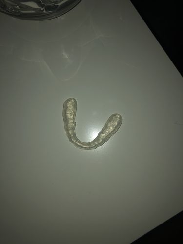 Customer photo review of Night Guard