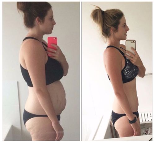 Customer photo review of Postpartum Belly Band