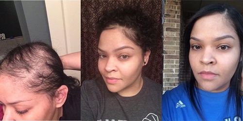 Customer photo review of PureFix Hair Elixir