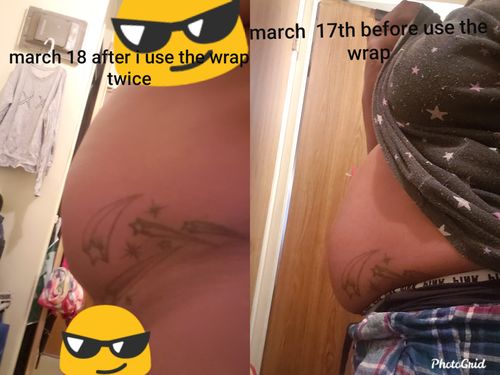 Customer photo review of Not live BOGO FREE 15 Uses Magnesium Therapy Wrap