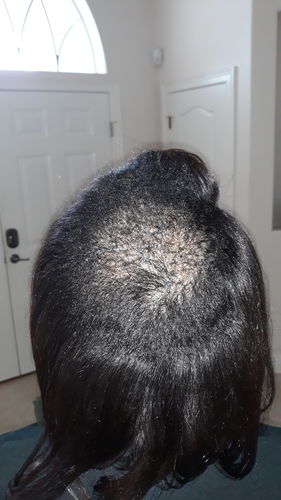 Customer photo review of PureFix Hair Elixir