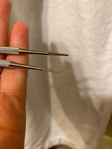 Customer photo review of Correcteur d'ongle incarné - Orteil & main