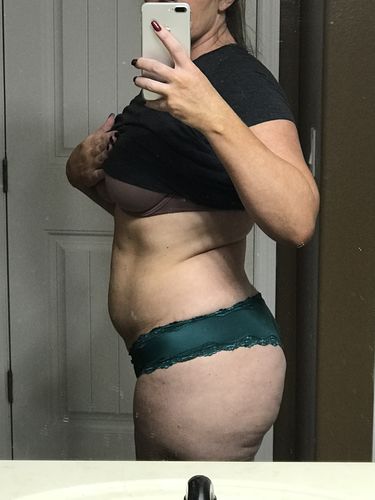 Customer photo review of 90 Uses Full Body with Renewal Serum, Awaken Serum and Cellulite Scrub