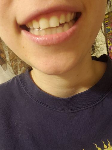 Customer photo review of Night Guard