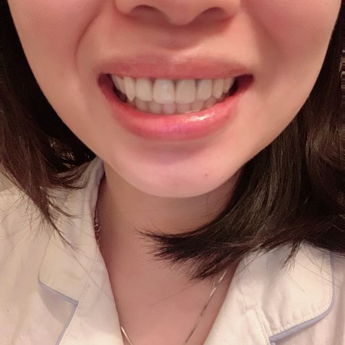 Customer photo review of Night Guard