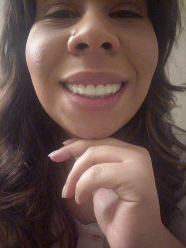 Customer photo review of Night Guard