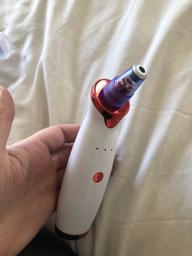 Customer photo review of Blackhead Vacuum Remover