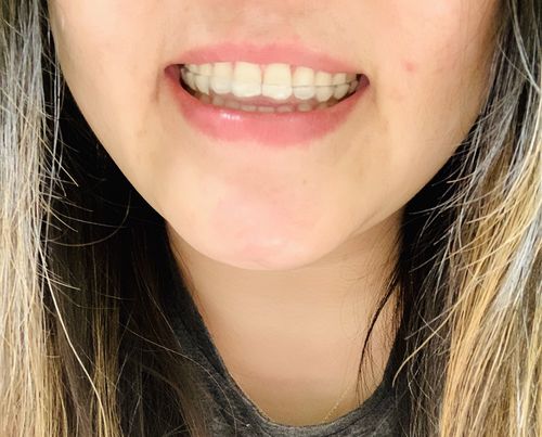 Customer photo review of Night Guard