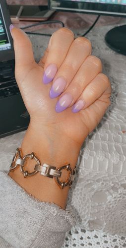 Customer photo review of Classic Link Bracelet for the Apple Watch in Rose Gold, Gold, or Silver