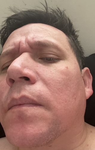 Customer photo review of (BOGO) AWAKEN: Skin Repair Intensive Healing Serum