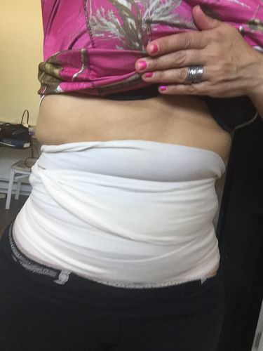 Customer photo review of 45 Uses Herbal Magnesium Therapy Wrap: Legs/Core