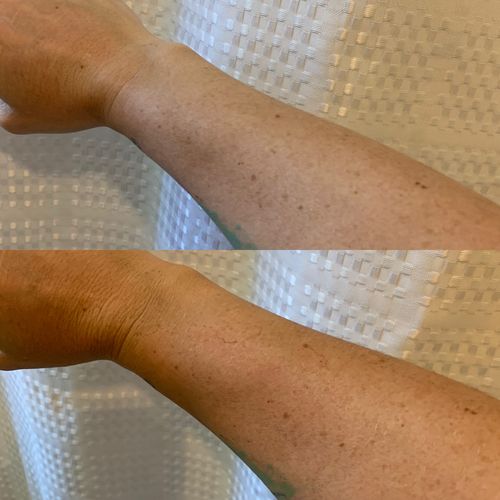 Customer photo review of FB Flawless Mousse & Mitt