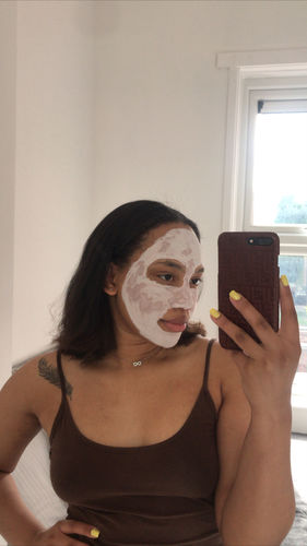 Customer photo review of Complete Skincare Bundle