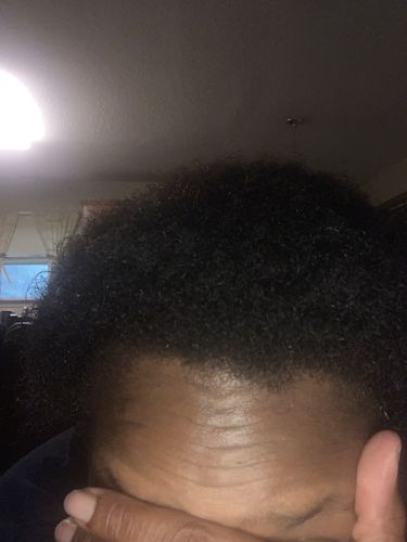 Customer photo review of PureFix Hair Elixir