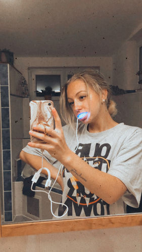 Customer photo review of CocoStrips