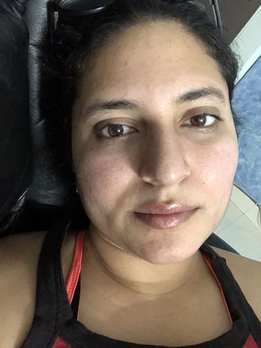 Customer photo review of Radiance Beauty-Boosting Day Face Elixir