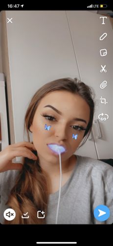 Customer photo review of PAP+ LED Teeth Whitening Kit