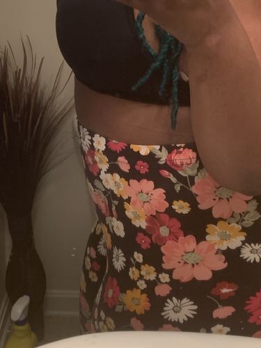 Customer photo review of 45 Uses Herbal Magnesium Therapy Wrap: Legs/Core