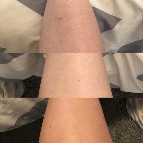 Customer photo review of 9 Minute Tan Mousse