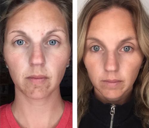 Customer photo review of Lumière Rouge ™