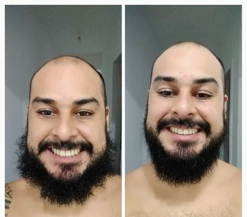 Customer photo review of Beard Straightener (Heated Combing Brush)
