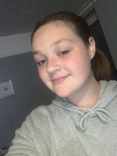 Customer photo review of SkinGlow Electric Cleanser - No More Blackheads