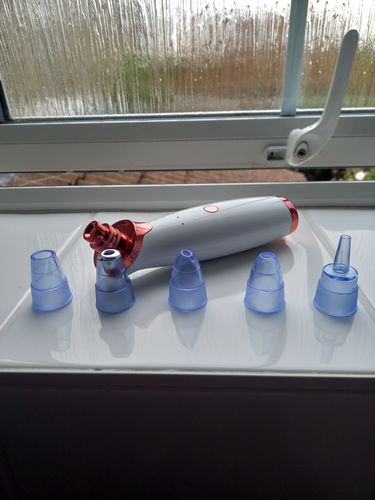 Customer photo review of SkinGlow Electric Cleanser - No More Blackheads