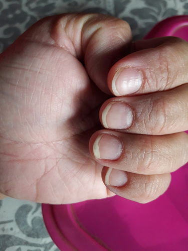 Customer photo review of Vitaminas Hairfy