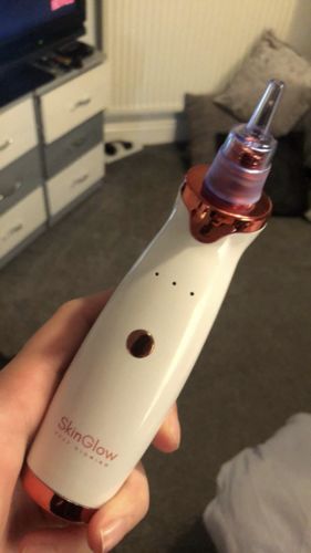 Customer photo review of SkinGlow Electric Cleanser - No More Blackheads