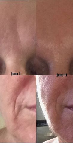 Customer photo review of Lumière Rouge ™