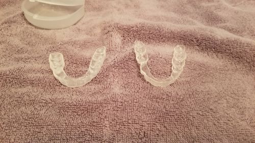 Customer photo review of Night Guard - Yearly