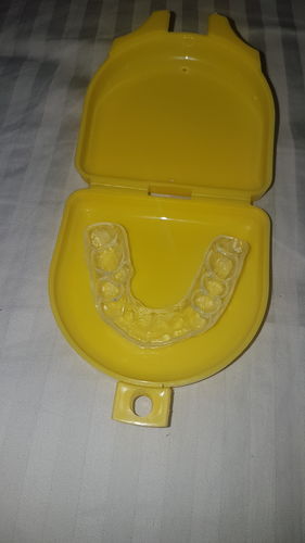 Customer photo review of SleepPro Night Guard