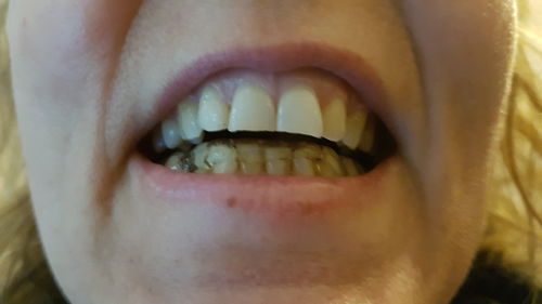 Customer photo review of Ecosym Dental Cleaning Bath