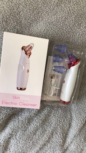Customer photo review of SkinGlow Electric Cleanser - No More Blackheads