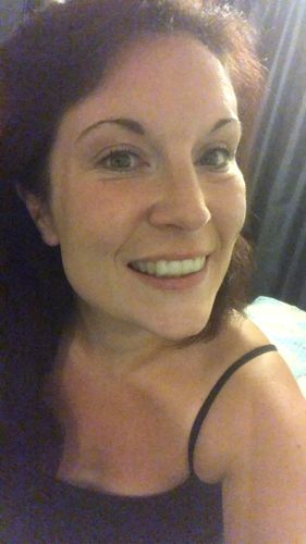 Customer photo review of SleepPro Night Guard