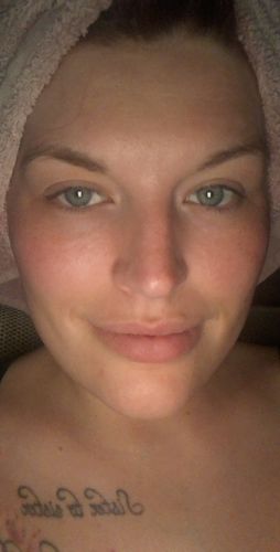 Customer photo review of SkinGlow Electric Cleanser - No More Blackheads