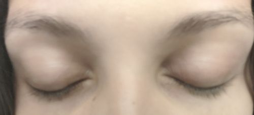 Customer photo review of Lash & Brow Enhancing Serum