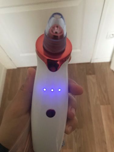 Customer photo review of SkinGlow Electric Cleanser - No More Blackheads