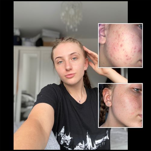 Customer photo review of Complete Daily Bundle