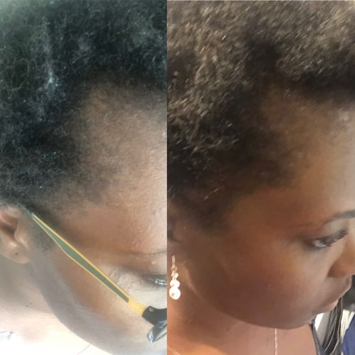 Customer photo review of Good Hair Vitamins - 3 mois