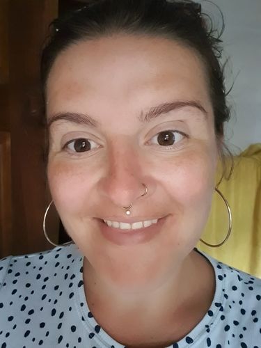 Customer photo review of SkinGlow Electric Cleanser - No More Blackheads