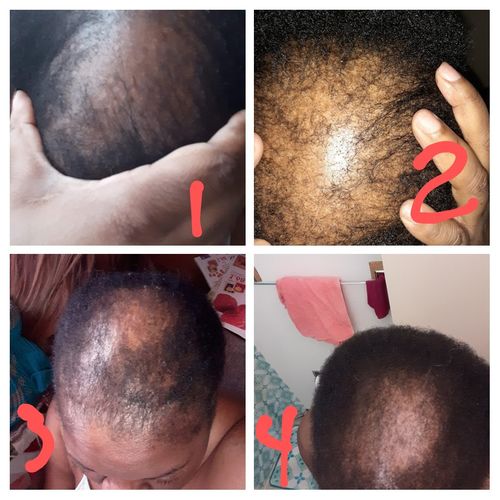 Customer photo review of PureFix Hair Elixir