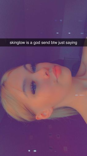 Customer photo review of SkinGlow Electric Cleanser - No More Blackheads