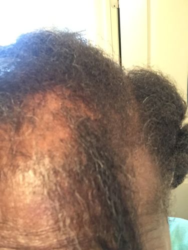 Customer photo review of Nae Nae's 9oz Hair Boost Special