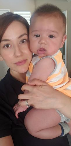 Customer photo review of (BOGO) AWAKEN: Skin Repair Intensive Healing Serum